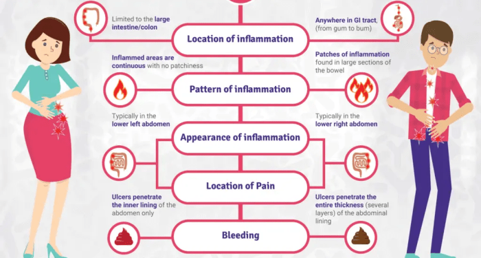 Inflammatory Bowel Disease Digital Toolkit for the Newly Diagnosed ...